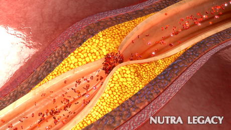Deadly Misdiagnosed Diseases Deadly Misdiagnosed Diseases