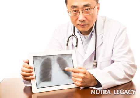Mesothelioma Lung Cancer Mesothelioma Lung Cancer