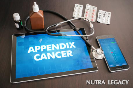What Is Appendix Cancer What Is Appendix Cancer
