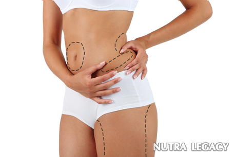 Liposuction Before And After Liposuction Before And After
