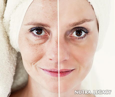 Aging Skin Aging Skin