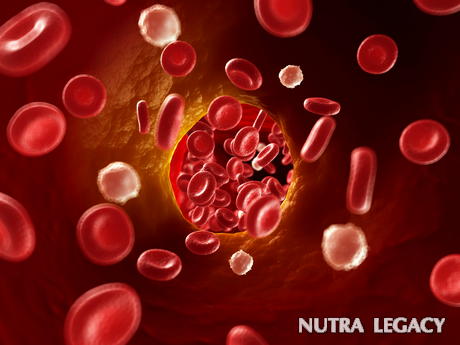 Clogged Arteries Surgery Clogged Arteries Surgery