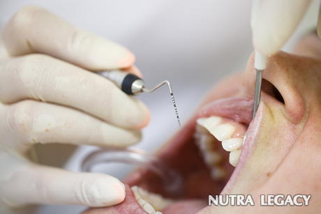 Periodontal Disease and Heart Disease