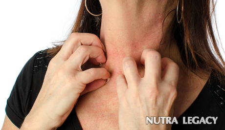 Eczema Skin Condition