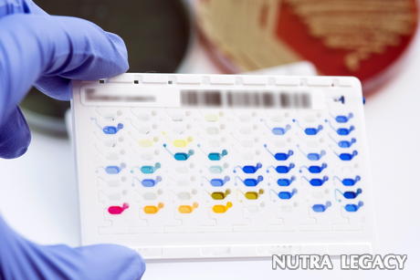 More Reasons to Take a Food Sensitivity Test More Reasons to Take a Food Sensitivity Test
