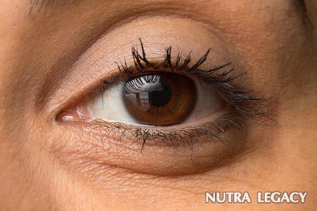 Glaucoma Natural Treatment Glaucoma Natural Treatment