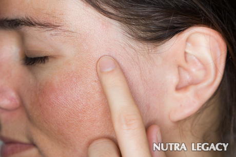 Hidden Skin Problems Hidden Skin Problems