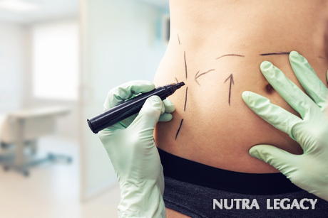 Vaser Liposuction Vaser Liposuction