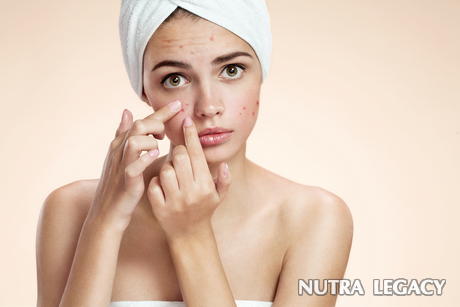 Immune System Effect On Acne Immune System Effect On Acne