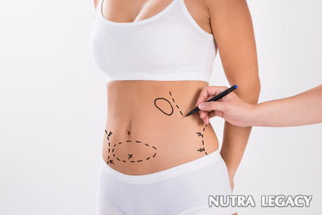 Liposuction Cost Liposuction Cost