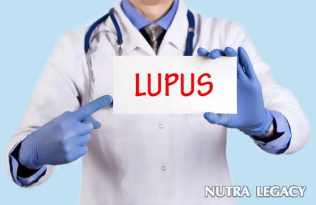 lupus lupus