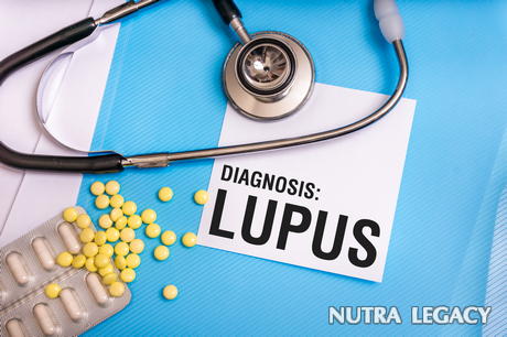 lupus lupus