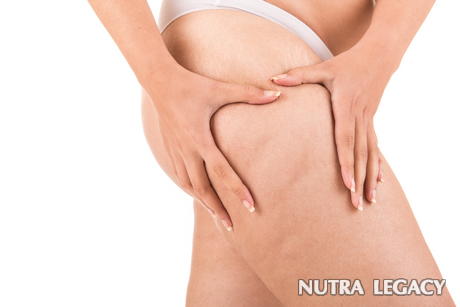 Natural Cellulite Treatments Natural Cellulite Treatments