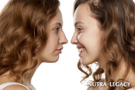 Peculiarities of korean rhinoplasty Peculiarities of korean rhinoplasty