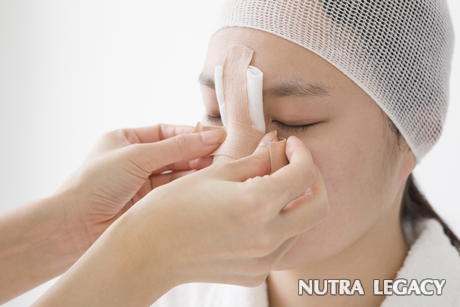 Recovery from rhinoplasty