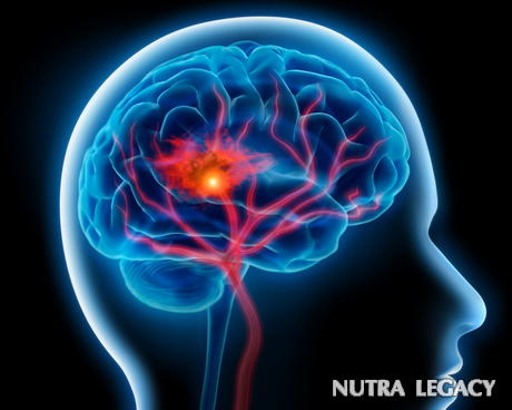 How to Survive a Stroke