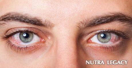 The 10 Major Causes Of Burst Blood Vessel In Eye The 10 Major Causes Of Burst Blood Vessel In Eye