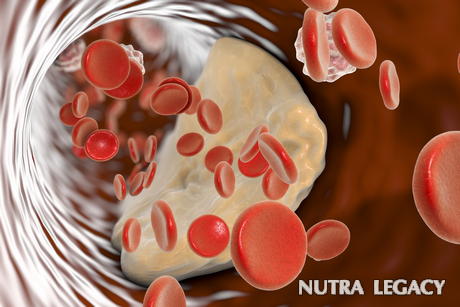 The Major Symptoms Of Clogged Arteries The Major Symptoms Of Clogged Arteries