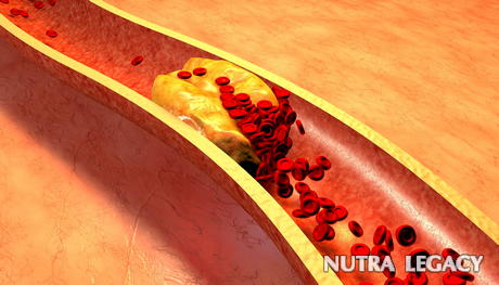 Treatments For Clogged Arteries - 7 Remedies To Clean Clogged Arteries Treatments For Clogged Arteries - 7 Remedies To Clean Clogged Arteries