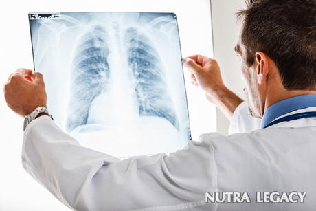 Viral Pneumonia Viral Pneumonia