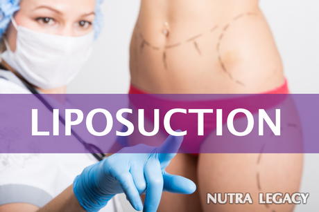 Weight Loss Surgery Options