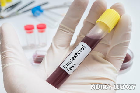 Normal cholesterol levels Normal cholesterol levels