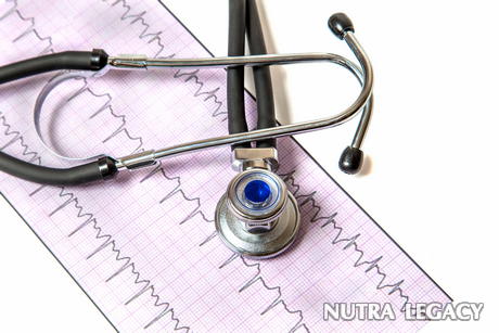 What Is an Arrhythmia
