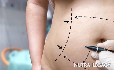Non-invasive Liposuction Non-invasive Liposuction